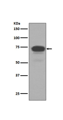 Anti-5T4 TPBG Rabbit Monoclonal Antibody Boster Bio