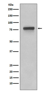 Anti-5T4 TPBG Rabbit Monoclonal Antibody Boster Bio