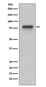 Anti-5T4 TPBG Rabbit Monoclonal Antibody Boster Bio