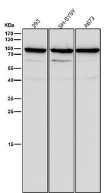 Anti-SCIN Rabbit Monoclonal Antibody Boster Bio