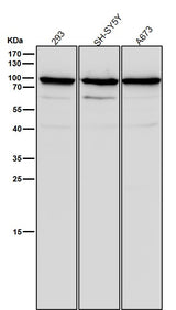 Anti-SCIN Rabbit Monoclonal Antibody Boster Bio