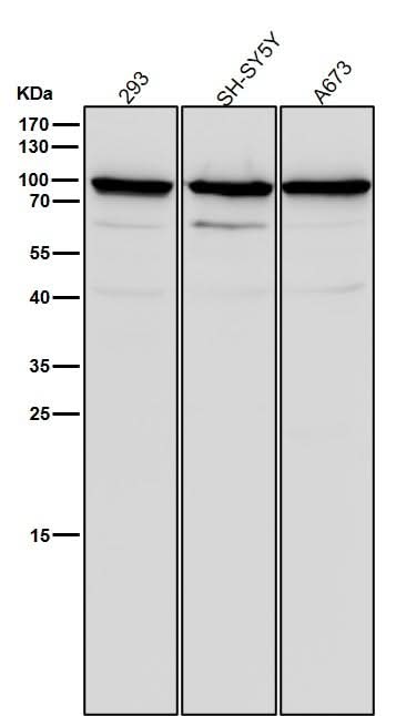 Anti-SCIN Rabbit Monoclonal Antibody Boster Bio