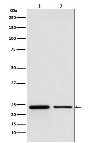 Anti-TBPL1 Monoclonal Antibody Boster Bio