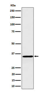 Anti-Pyrophosphatase 1 Rabbit Monoclonal Antibody Boster Bio