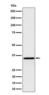 Anti-Pyrophosphatase 1 Rabbit Monoclonal Antibody Boster Bio