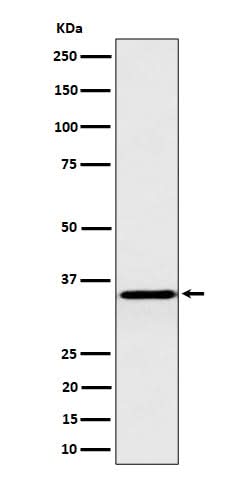 Anti-Pyrophosphatase 1 Rabbit Monoclonal Antibody Boster Bio