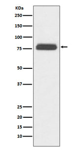 Anti-TBR1 Rabbit Monoclonal Antibody Boster Bio