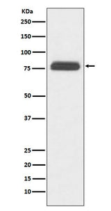 Anti-TBR1 Rabbit Monoclonal Antibody Boster Bio