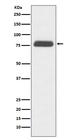 Anti-TBR1 Rabbit Monoclonal Antibody Boster Bio