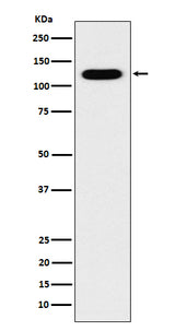 Anti-Cadherin 16 CDH16 Monoclonal Antibody Boster Bio