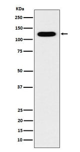 Anti-Cadherin 16 CDH16 Monoclonal Antibody Boster Bio
