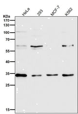 Anti-NUDT5 Rabbit Monoclonal Antibody Boster Bio