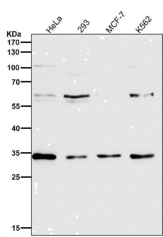 Anti-NUDT5 Rabbit Monoclonal Antibody Boster Bio