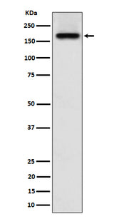 Anti-SARA Rabbit Monoclonal Antibody Boster Bio