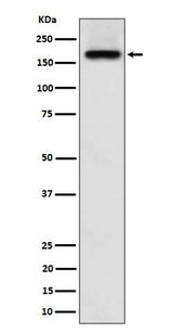 Anti-SARA Rabbit Monoclonal Antibody Boster Bio