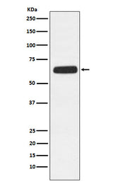 Anti-CD89 Rabbit Monoclonal Antibody Boster Bio