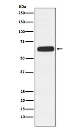 Anti-CD89 Rabbit Monoclonal Antibody Boster Bio