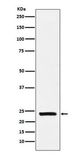 Anti-Casein Rabbit Monoclonal Antibody Boster Bio