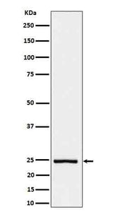 Anti-IL26 Rabbit Monoclonal Antibody Boster Bio