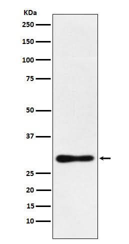 Anti-DDAH2 Monoclonal Antibody Boster Bio