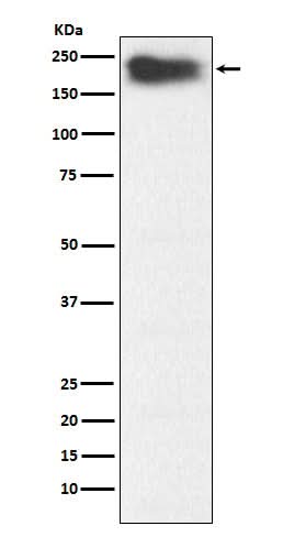 Anti-MYH7B Rabbit Monoclonal Antibody Boster Bio