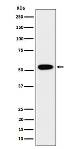 Anti-GRSF1 Rabbit Monoclonal Antibody Boster Bio