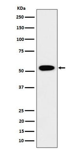 Anti-GRSF1 Rabbit Monoclonal Antibody Boster Bio