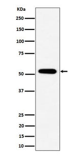 Anti-PPP2R5E Rabbit Monoclonal Antibody Boster Bio