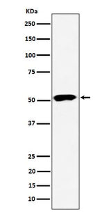 Anti-PPP2R5E Rabbit Monoclonal Antibody Boster Bio
