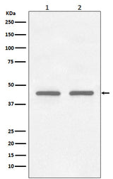 Anti-FNTB Rabbit Monoclonal Antibody Boster Bio