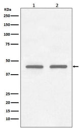 Anti-FNTB Rabbit Monoclonal Antibody Boster Bio