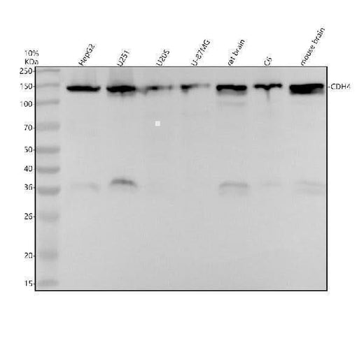 Anti-R Cadherin Rabbit Monoclonal Antibody Boster Bio