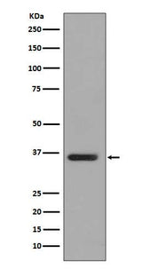 Anti-PP2A alpha + beta Rabbit Monoclonal Antibody Boster Bio