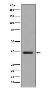 Anti-PP2A alpha + beta Rabbit Monoclonal Antibody Boster Bio