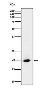 Anti-SRP19 Rabbit Monoclonal Antibody Boster Bio