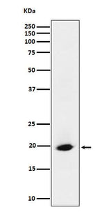 Anti-SRP19 Rabbit Monoclonal Antibody Boster Bio