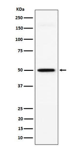 Anti-GPA33 Rabbit Monoclonal Antibody Boster Bio