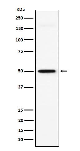 Anti-GPA33 Rabbit Monoclonal Antibody Boster Bio