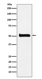 Anti-ULK3 Monoclonal Antibody Boster Bio