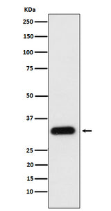 Anti-Apolipoprotein F Rabbit Monoclonal Antibody Boster Bio