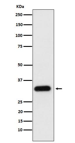 Anti-Apolipoprotein F Rabbit Monoclonal Antibody Boster Bio