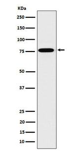 Anti-DPP3 Rabbit Monoclonal Antibody Boster Bio