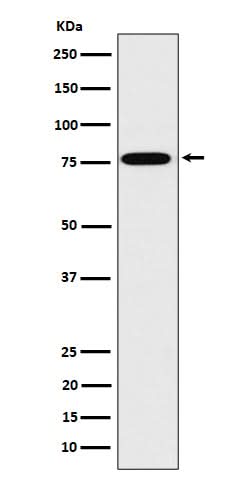 Anti-DPP3 Rabbit Monoclonal Antibody Boster Bio