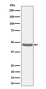 Anti-BCKDK Rabbit Monoclonal Antibody Boster Bio