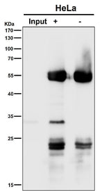 Anti-Apg10 (Atg10) Rabbit Monoclonal Antibody Boster Bio