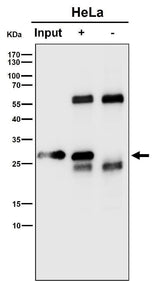 Anti-RPS8 Rabbit Monoclonal Antibody Boster Bio