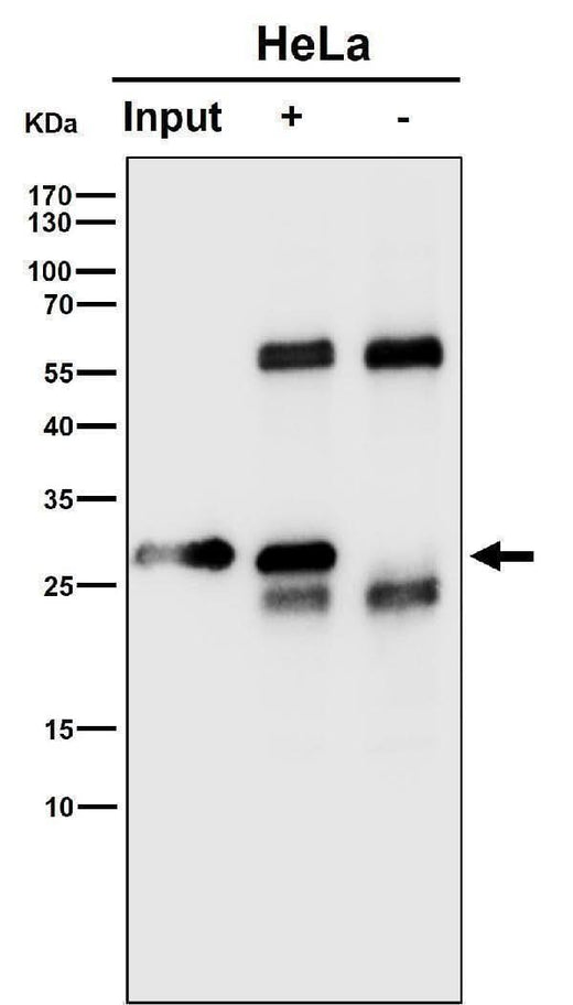 Anti-RPS8 Rabbit Monoclonal Antibody Boster Bio