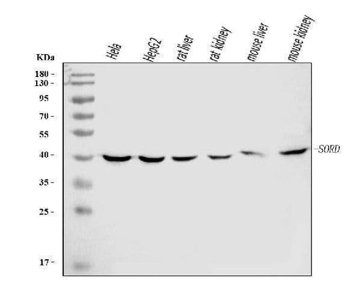 Anti-Sorbitol Dehydrogenase/SORD Antibody Picoband® (monoclonal, 12B10G2 Boster Bio