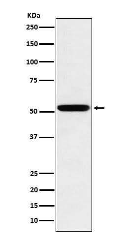 Anti-Human IgG2 Rabbit Monoclonal Antibody Boster Bio