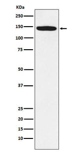 Anti-HTSF1 Rabbit Monoclonal Antibody Boster Bio